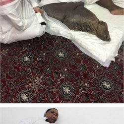 حادث يدخل اثنين غرف التنويم بالمستشفى