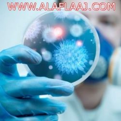 الملاح الجوي يروي تفاصيل ضرب العائلة السعودية بمطار إسطنبول